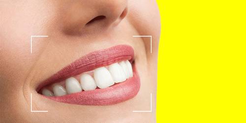 آیا چای و قهوه مانند دندان های طبیعی لمینت دندان را لکه دار می کنند؟